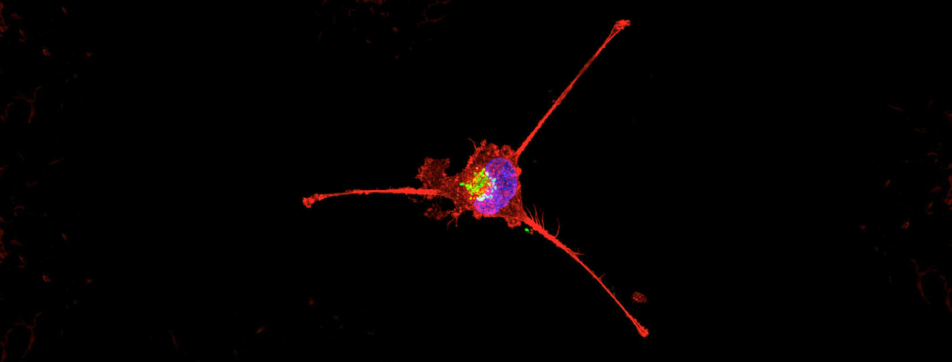 Fasting and Cancer Treatment